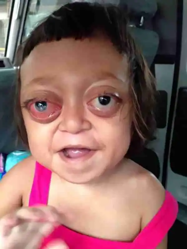 Heartbreaking: See the Disabled Girl Who Was Sold Off to a Gang and Forced to Beg on the Street